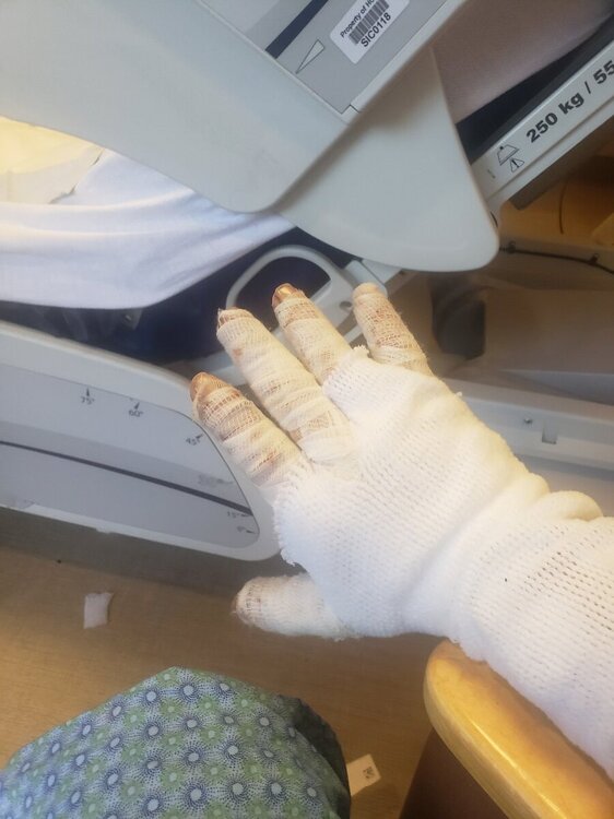 HCMC Burn unit Page 3 General Chat Red Power Magazine Community