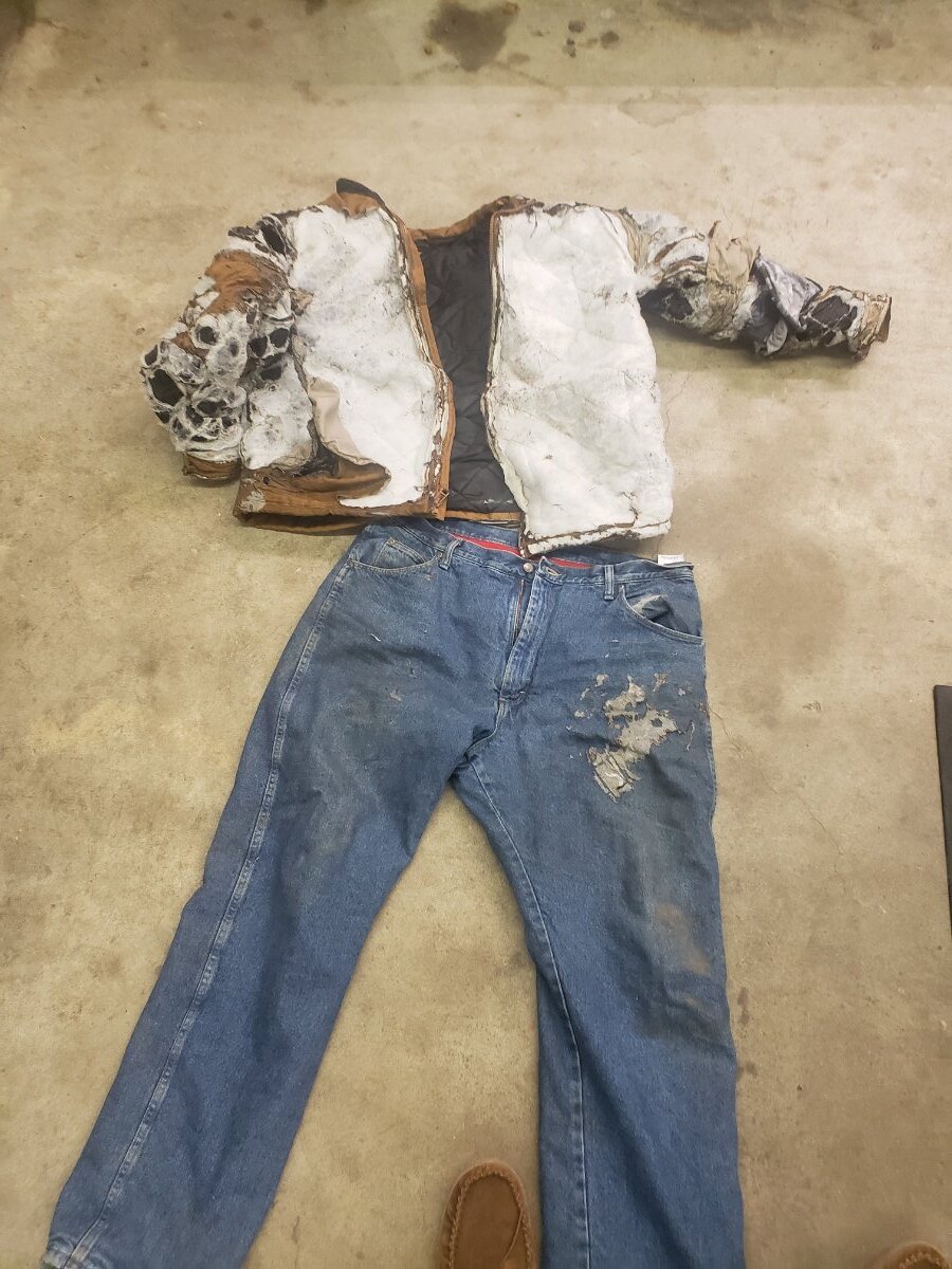 HCMC Burn unit Page 4 General Chat Red Power Magazine Community