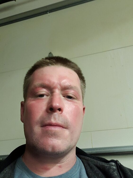 HCMC Burn unit Page 5 General Chat Red Power Magazine Community