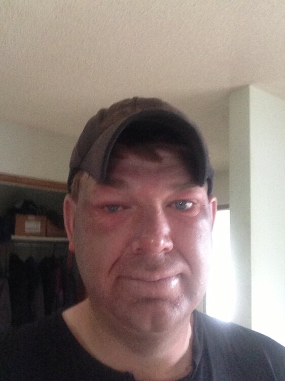 HCMC Burn unit Page 4 General Chat Red Power Magazine Community